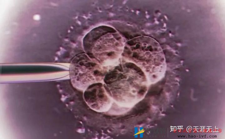 30歲產婦做試管嬰兒全過程,看完心疼女人一萬遍!(圖5)
