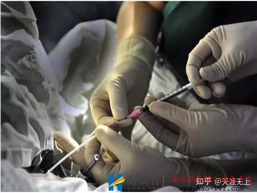 30歲產婦做試管嬰兒全過程,看完心疼女人一萬遍!(圖7)