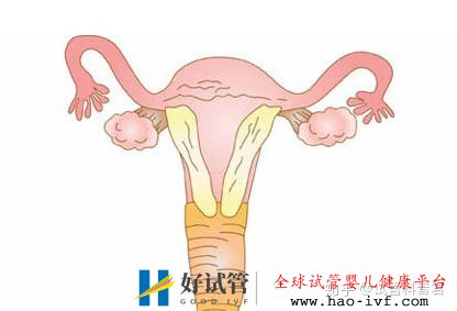 這四種男女,要盡早做試管嬰兒,不然晚了后悔死(圖3)