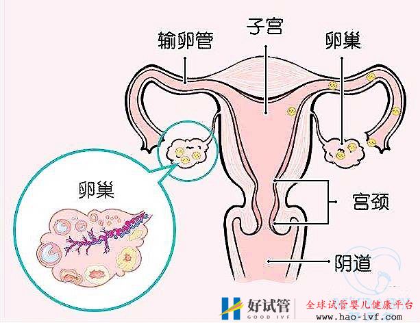 排卵障礙能做試管嬰兒嗎？成功率多少？(圖1)