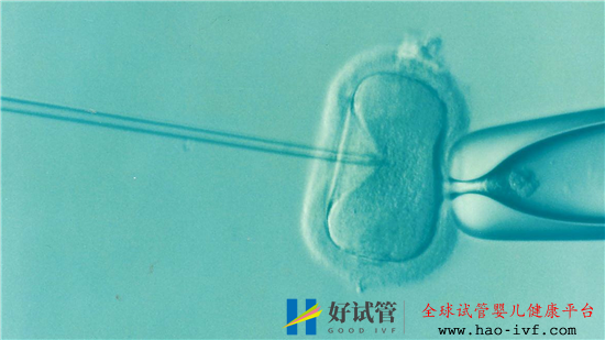 試管嬰兒的成功率有多高呢(圖1) 試管嬰兒的成功率有多高呢(圖1)