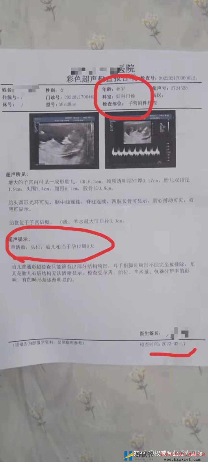 48歲做試管嬰兒第三代成功率多少(圖1)