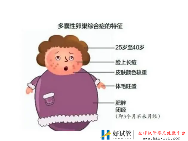 多囊患者可以做試管嬰兒嗎？試管成功率大嗎？(圖3)