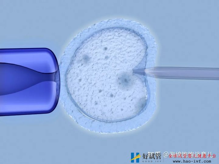 試管嬰兒1代、2代、3代、4代哪個(gè)最好真實(shí)操作過...(圖12)