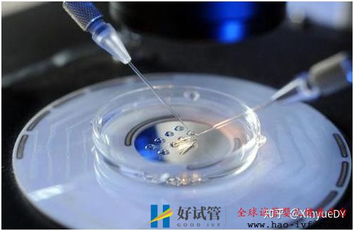 詳解第一代、第二代、第三代試管嬰兒以及適應(yīng)癥,...(圖3)