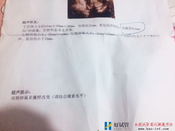 接好孕,多囊卵巢綜合癥的我,做試管不生雙胞胎后悔了(圖4)