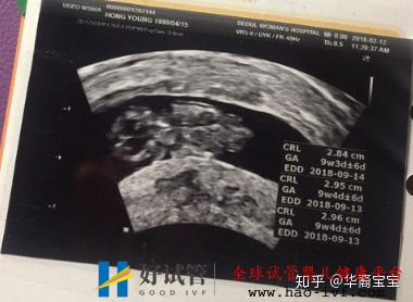 我剛做完試管,告訴你們今年試管嬰兒價格多少錢(圖1)