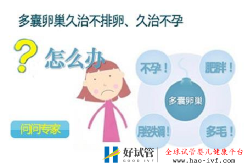 多囊卵巢綜合癥可以試管嗎(圖2)