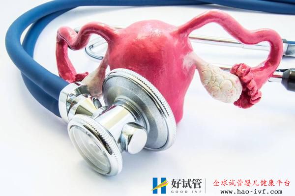 多囊卵巢綜合征如何定義？醫生：患上多囊卵巢綜合征要對癥治療(圖1)