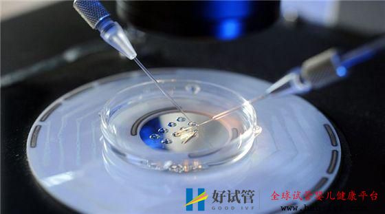 多囊卵巢綜合癥能做試管嬰兒嗎？(圖2)