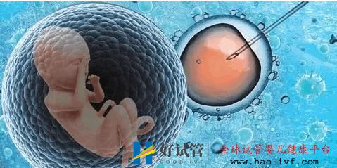 泰國試管嬰兒費用第二代和第三代的相差多少(圖2)
