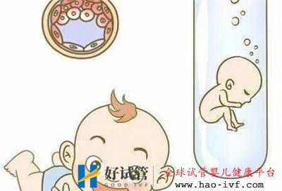 多囊想懷孕一定要做三代試管嬰兒嗎？(圖1)
