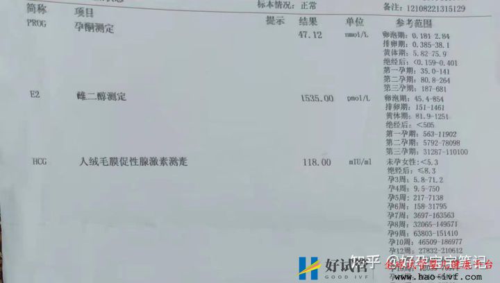 多囊多年至不孕,試管移植二次成功!經(jīng)驗分享!(圖3) 多囊多年至不孕,試管移植二次成功!經(jīng)驗分享!(圖3)