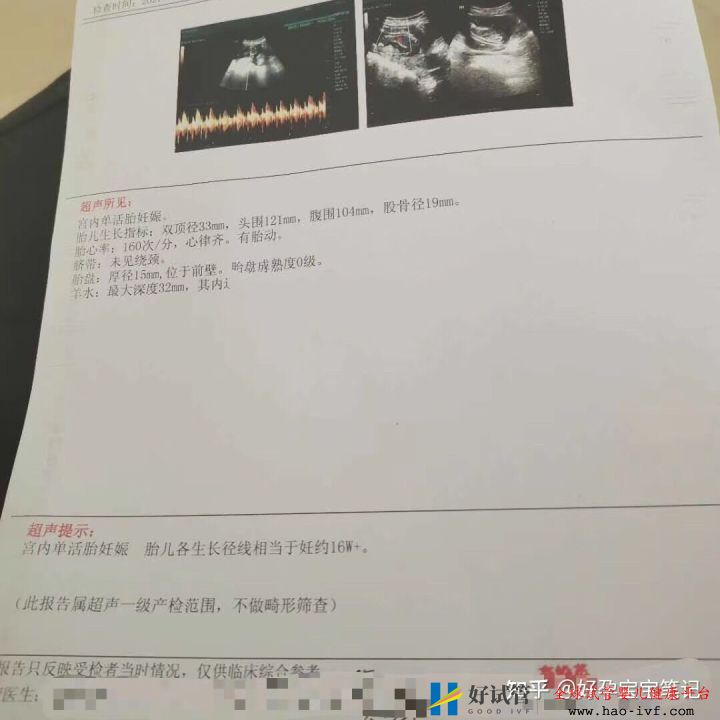 多囊多年至不孕,試管移植二次成功!經(jīng)驗分享!(圖6) 多囊多年至不孕,試管移植二次成功!經(jīng)驗分享!(圖6)