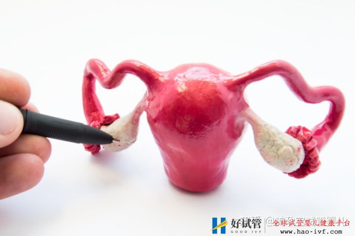 多囊做試管成功率如何不孕不育,多囊國內(nèi)可以做三...(圖1) 多囊做試管成功率如何不孕不育,多囊國內(nèi)可以做三...(圖1)