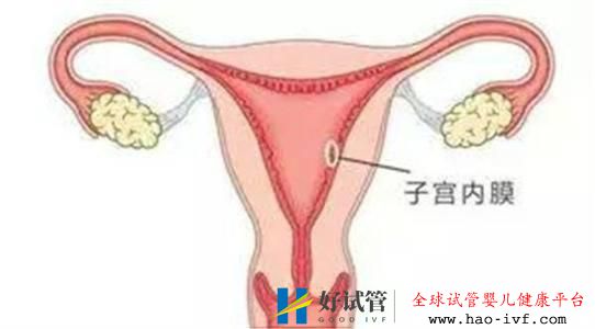 做俄羅斯試管嬰兒需要調(diào)理內(nèi)膜嗎？調(diào)內(nèi)膜一般要多少天(圖1)
