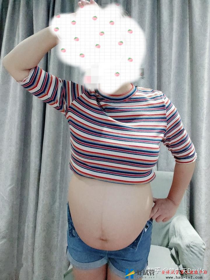 35歲卵巢早衰做供卵試管成功懷上了寶寶,分享我的經(圖3)