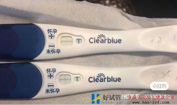 32歲卵巢早衰,通過試管移植一次成功懷孕經驗分享(圖5) 32歲卵巢早衰,通過試管移植一次成功懷孕經驗分享(圖5)