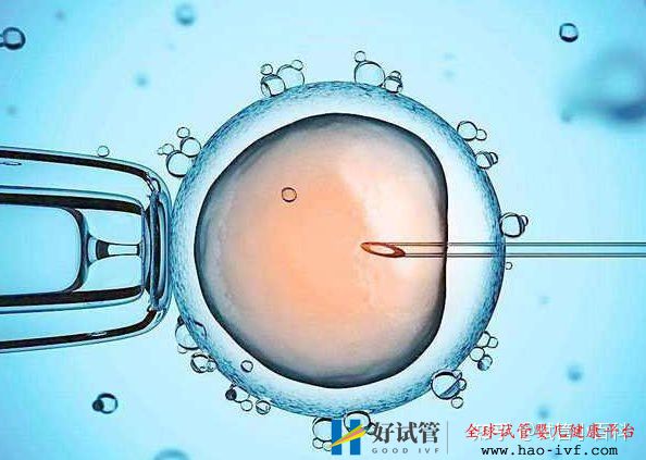 男性患有少精癥可以做試管嬰兒嗎(圖1)