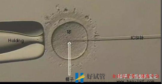 第三代試管嬰兒費用是多少,大致的流程有哪些(圖3)