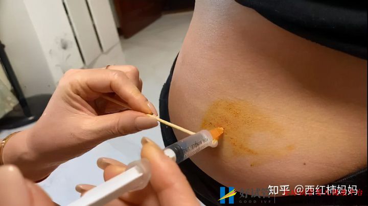 為何許多過來人不建議女性做“試管嬰兒”背后真...(圖3)