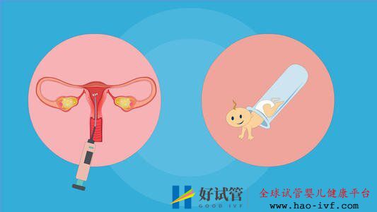 試管移植失敗后多久可以再次促排取卵(圖1)