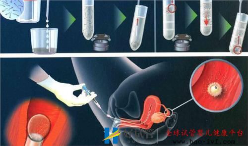 做試管期間可以喝蜂蜜水嗎移植后不能喝蜂蜜水嗎(圖1)