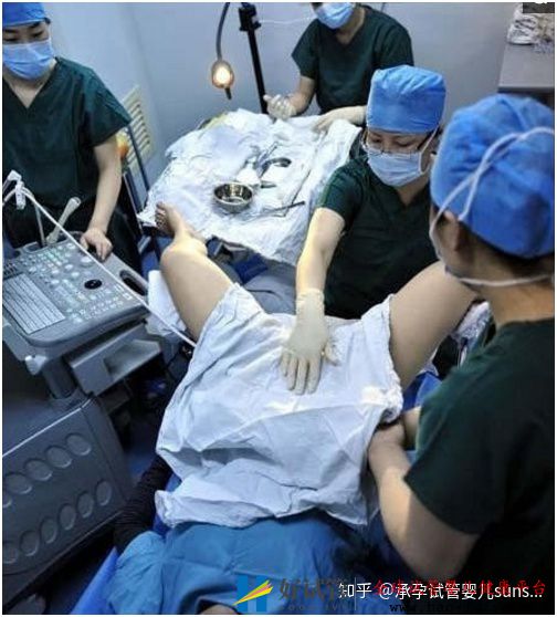 用7張圖還原試管嬰兒的全過程(圖1)