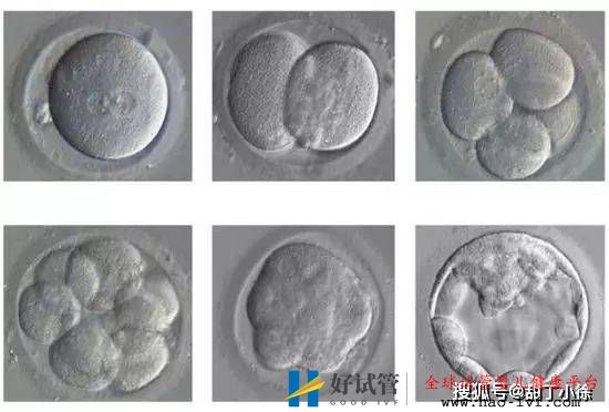 試管嬰兒移植后多久算成功(圖1)
