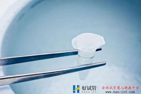 一文帶你了解試管嬰兒整個(gè)流程個(gè)各個(gè)環(huán)節(jié)時(shí)間節(jié)點(diǎn)的...(圖5)