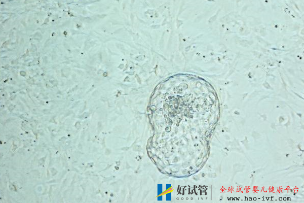 美國試管嬰兒囊胚培養優勢養囊率高低取決于什么？(圖2)