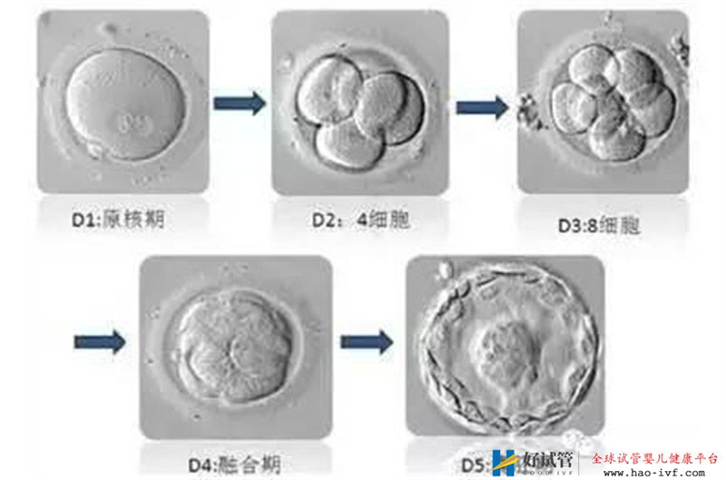 看完這篇試管嬰兒養囊的利弊，你會繼續選擇養囊嗎？(圖2)