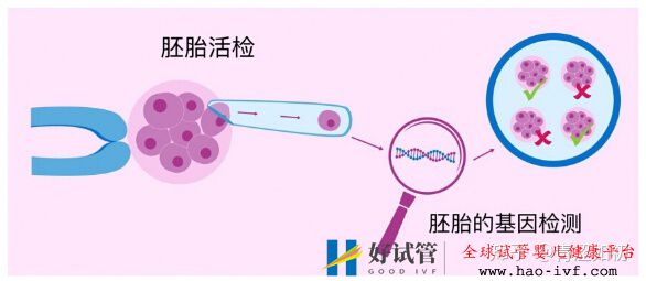 試管嬰兒的利弊分析(圖1)