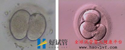 您無精少精的情況可以做試管嬰兒嗎(圖1)
