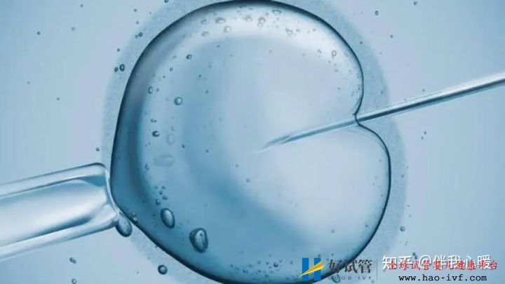 試管嬰兒需要花多少時間試管全流程大公開建議收藏!(圖5) 試管嬰兒需要花多少時間試管全流程大公開建議收藏!(圖5)