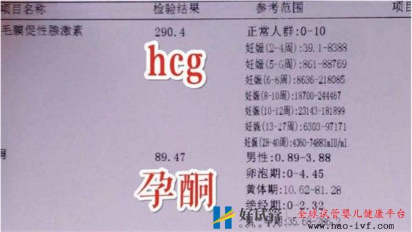 通過試管嬰兒移植后多久可以驗孕驗孕成功后多久可以測胎心(圖1) 通過試管嬰兒移植后多久可以驗孕驗孕成功后多久可以測胎心(圖1)