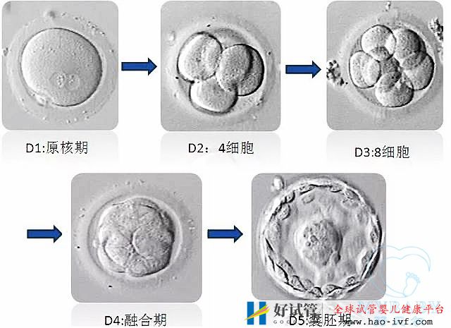 試管嬰兒凍胚和鮮胚哪個成功率高(圖1) 試管嬰兒凍胚和鮮胚哪個成功率高(圖1)