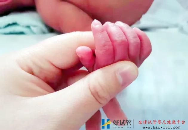 試管嬰兒雙胞胎龍鳳胎的概率(圖2)