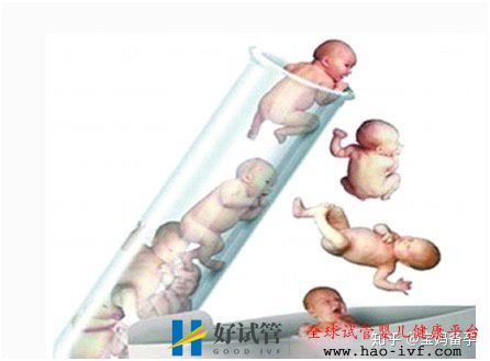 符合這三個條件中的其中一個,就可以做試管嬰兒了(圖1)