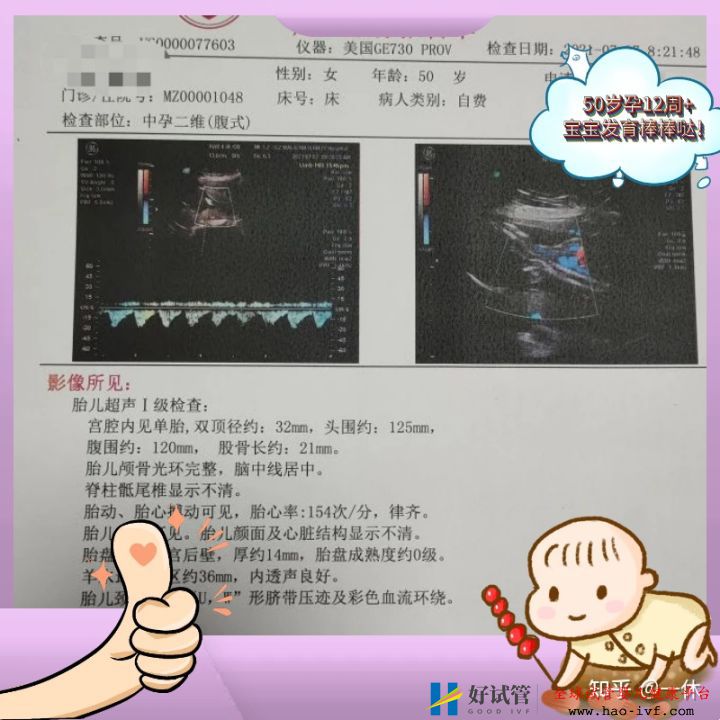 公立醫院做三代試管的條件,看看你真的能做嗎(圖1)