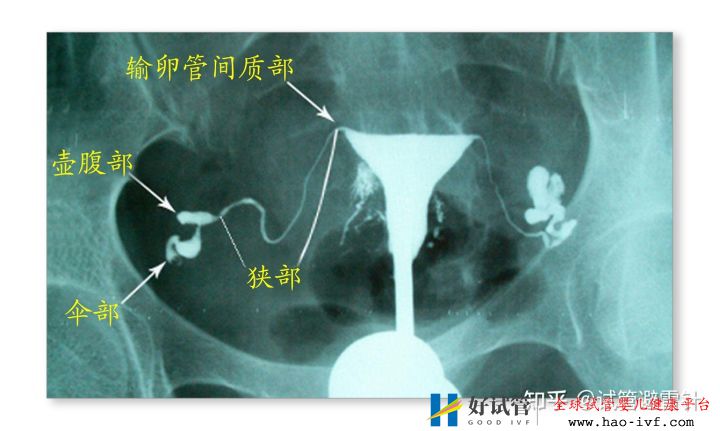 試管嬰兒需要什么條件才可以做——系列文2(圖2)