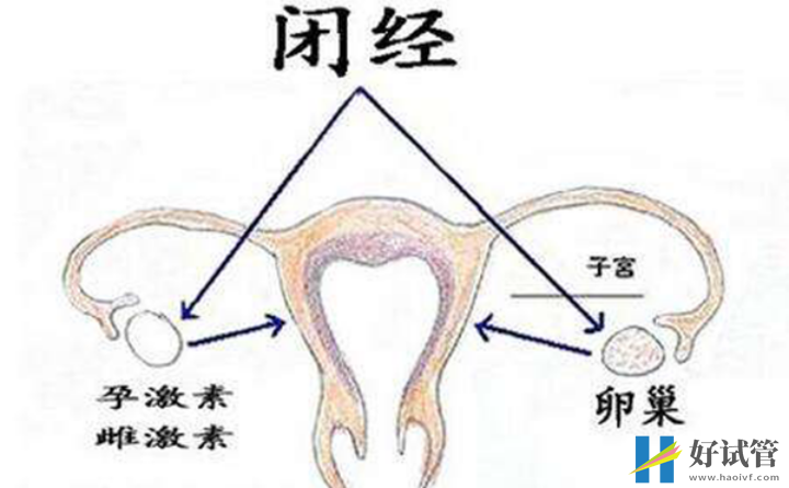 排卵障礙會(huì)影響女性月經(jīng)