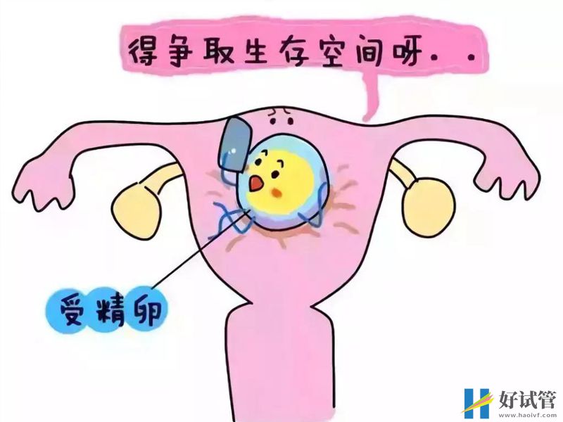 宮腔粘連有多種治療方式