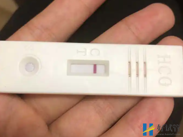 高泌乳素血癥會(huì)引起不孕