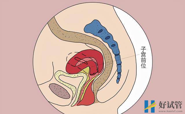 試管嬰兒并不是人人都能做，要符合哪些條件？成功后要注意什么？(圖1)