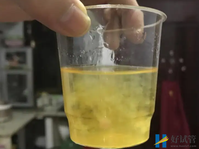 白醋加尿液混合物變渾濁是男孩