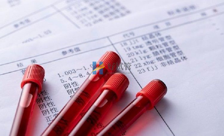 FSH值可判斷卵巢功能