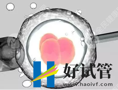 果洛有可以做第三代試管嬰兒的醫(yī)院嗎？(圖1)