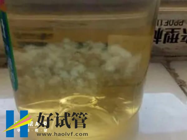 75%酒精測出女寶寶的狀態(tài)
