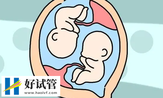 胚胎質(zhì)量的才能做試管雙生子